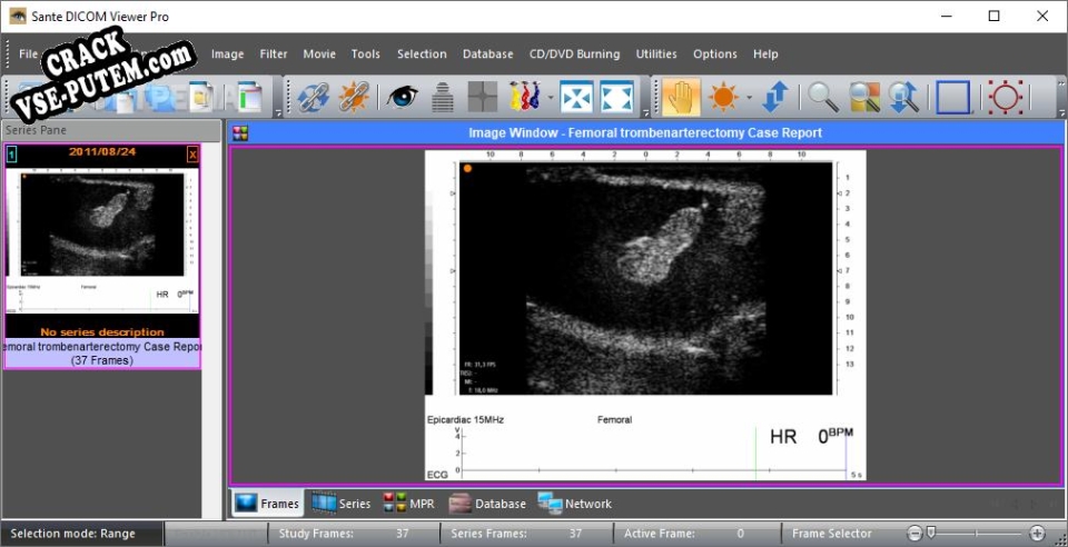 Ключ для Sante DICOM Viewer Pro